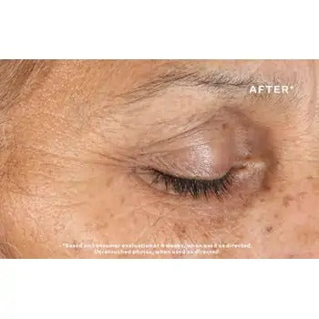 StriVectin Anti Wrinkle Intensive Eye Concentrate 30 ml