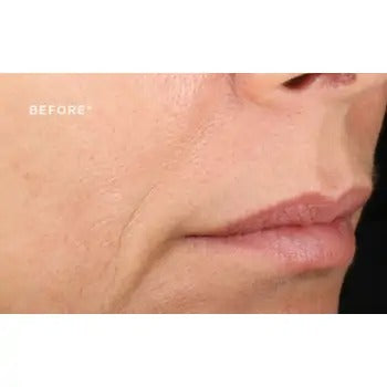 StriVectin Advanced Retinol Concentrated Serum 30 ml