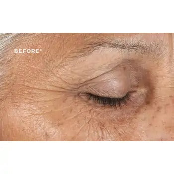 StriVectin Anti Wrinkle Intensive Eye Concentrate 30 ml