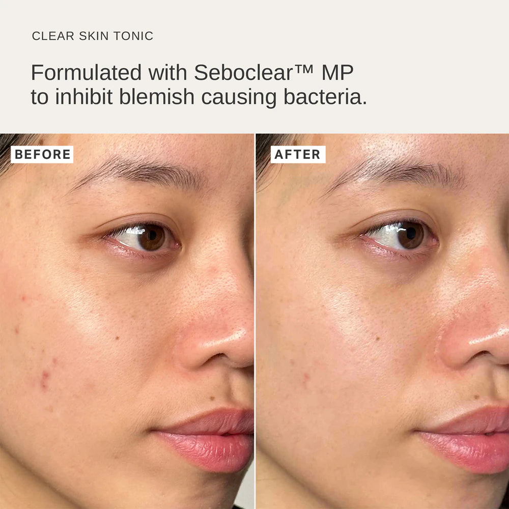 Alpha-H Clear Skin Tonic 100 ml