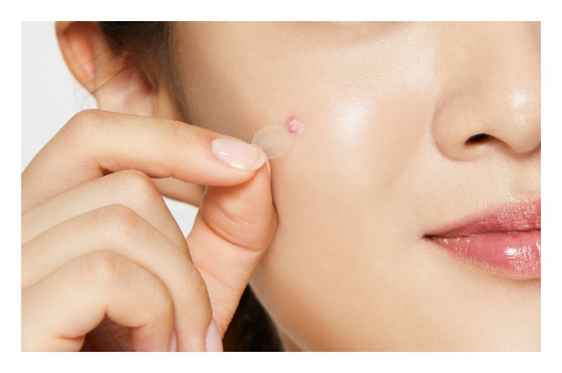 Cosrx Clear Fit Master Pimple Patch 18 pcs