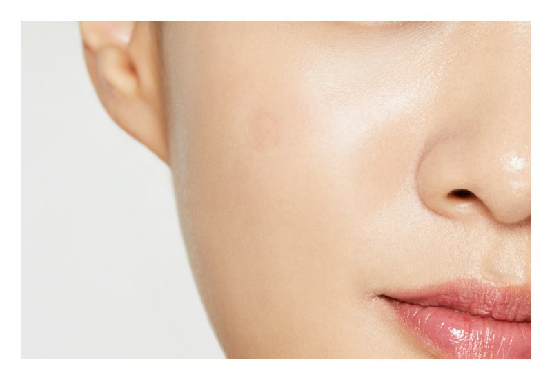 Cosrx Clear Fit Master Pimple Patch 18 pcs