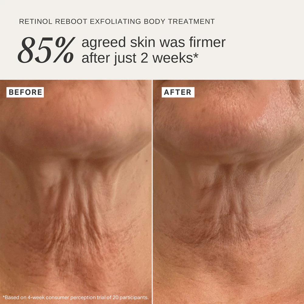 Alpha-H Retinol Reboot firming body care 120 ml